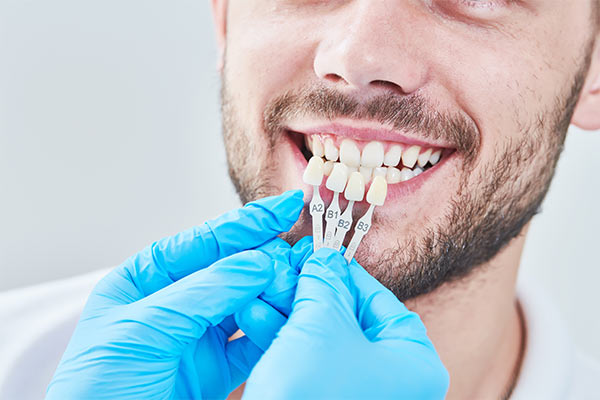 A man being sized for porcelain veneers.