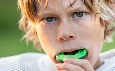 Summer Sports & Your Smile: How to Protect Your Teeth