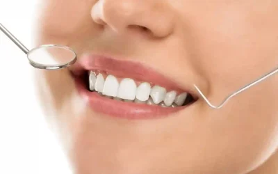 How to Know If You Have a Cavity